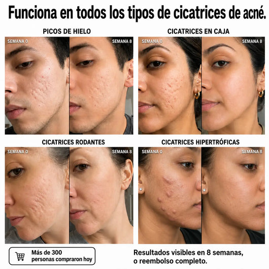 Stick Clínico Reparador de Cicatrices de Acné™