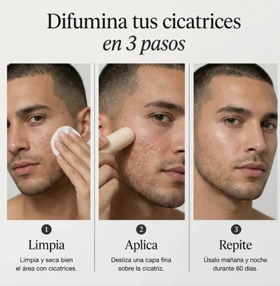 Stick de Silicona Médica para Cicatrices de Acné™
