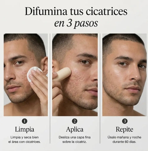 Stick de Silicona Médica para Cicatrices de Acné™